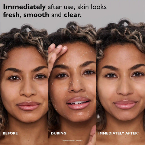 FIRMx Peeling Gel|3.4 fl oz