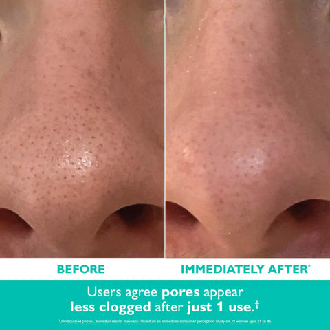 Even Smoother™ Microdermabrasion Exfoliating Pore Purifier|50 ml / 1.7 fl oz