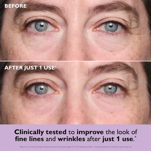 Instant FIRMx® Collagen Tightening Eye Patches