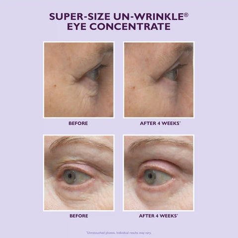 Super-Size Un-Wrinkle Eye Concentrate|30 ml / 1 oz